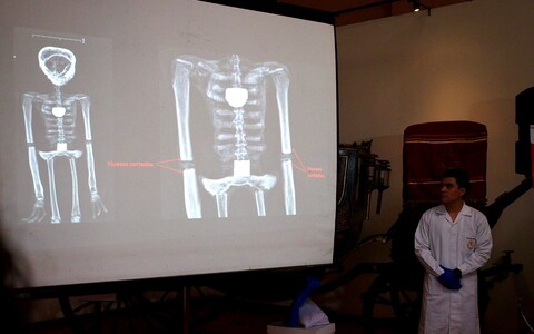  X-rays of the alleged aliens show some kind of three-fingered humanoid mummies