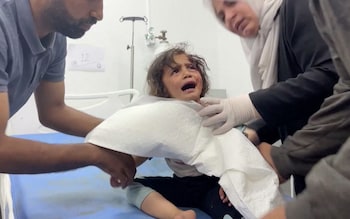 A Palestinian child wounded in the Israeli strike