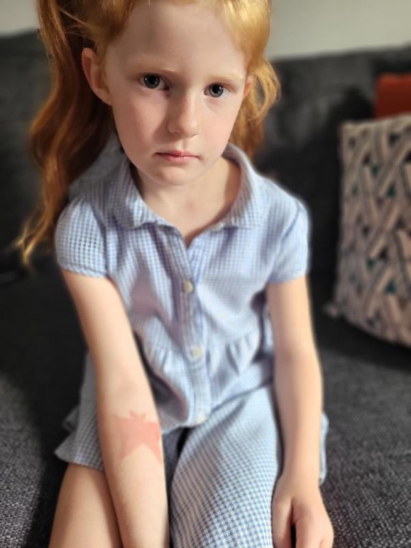 Photo of a girl holding her arm out in a blue polo collared dress, sitting on a couch. 