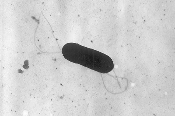 The image above provided by the Centers for Disease Co<em></em>ntrol and Prevention shows a Listeria mo<em></em>nocytogenes bacterium when seen under a microscope.